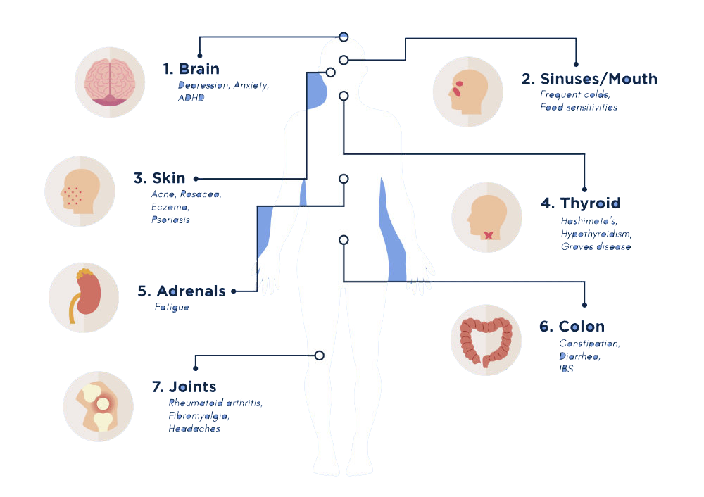  gastrointestinal gi tract leaky gut linkzradio klublinks shyparis shy paris gastro digestion organ health digestive